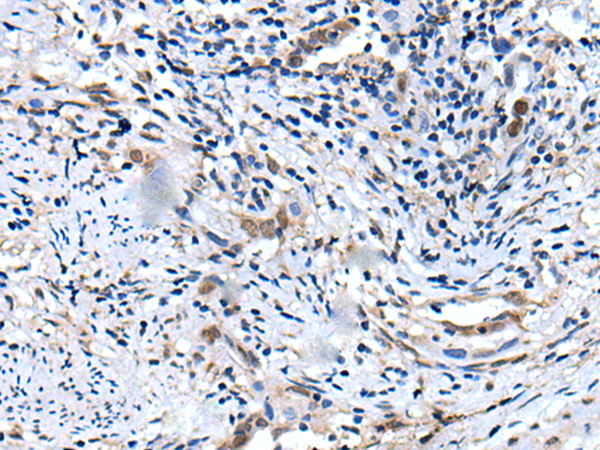 Rabbit Polyclonal Antibody to VENTX