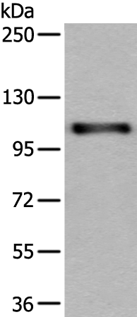 Rabbit Polyclonal Antibody to USO1