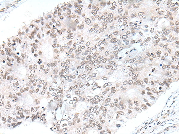 Rabbit Polyclonal Antibody to VGLL2