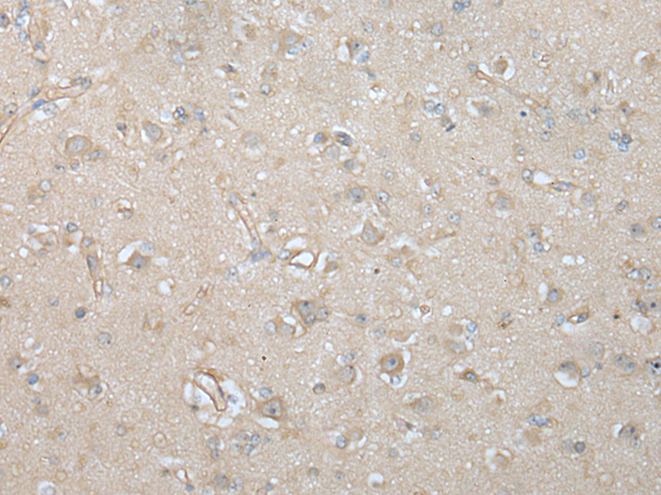 Rabbit Polyclonal Antibody to VILL