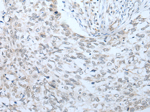 Rabbit Polyclonal Antibody to VNN2