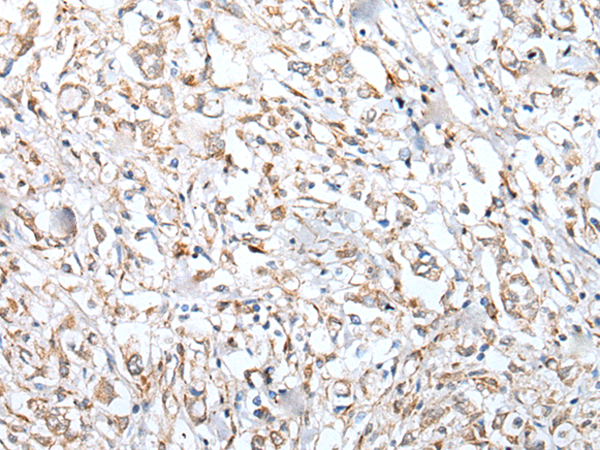 Rabbit Polyclonal Antibody to VPREB3