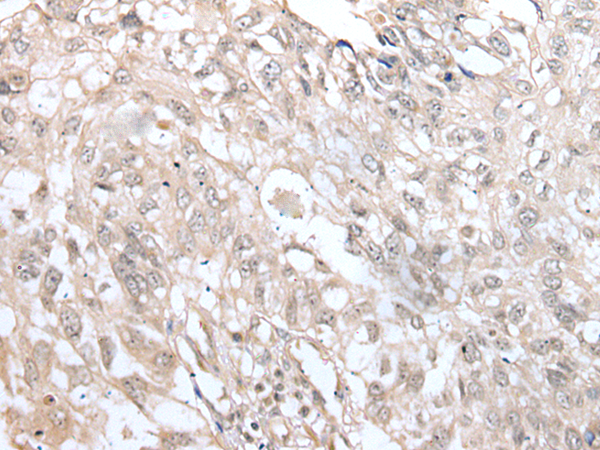 Rabbit Polyclonal Antibody to VRK3