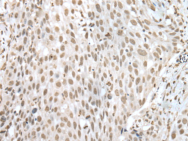 Rabbit Polyclonal Antibody to VSX1