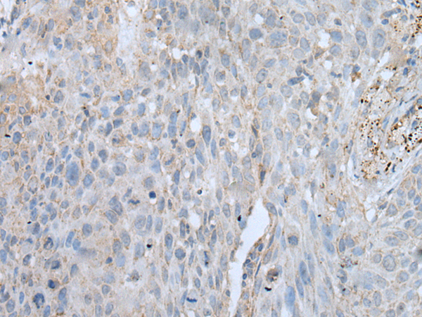 Rabbit Polyclonal Antibody to VWA2