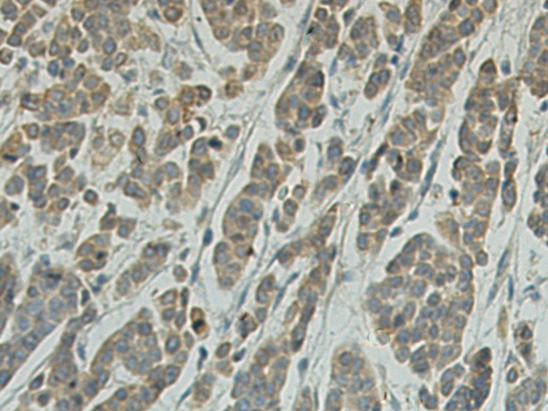 Rabbit Polyclonal Antibody to UAP1