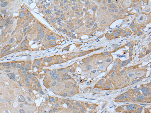Rabbit Polyclonal Antibody to UBA5