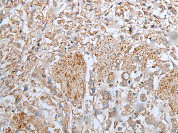 Rabbit Polyclonal Antibody to UBA6