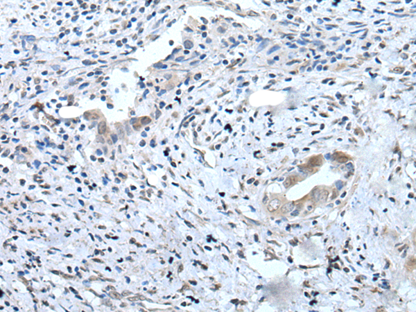 Rabbit Polyclonal Antibody to UBAC2