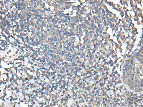 Rabbit Polyclonal Antibody to UBASH3A