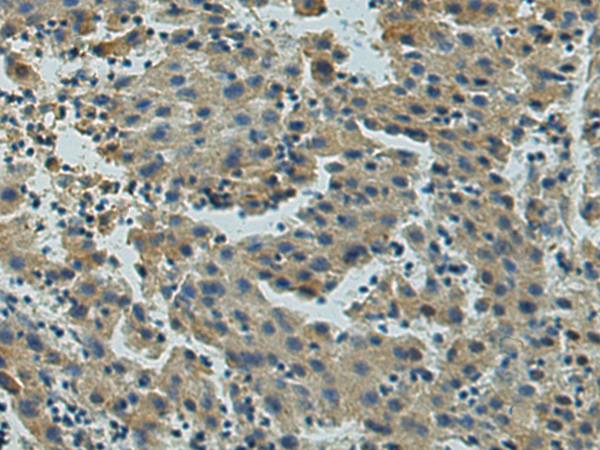 Rabbit Polyclonal Antibody to UBE2R2
