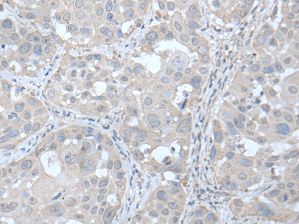 Rabbit Polyclonal Antibody to UBE2Q2