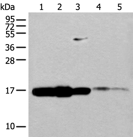 Rabbit Polyclonal Antibody to UBE2V1