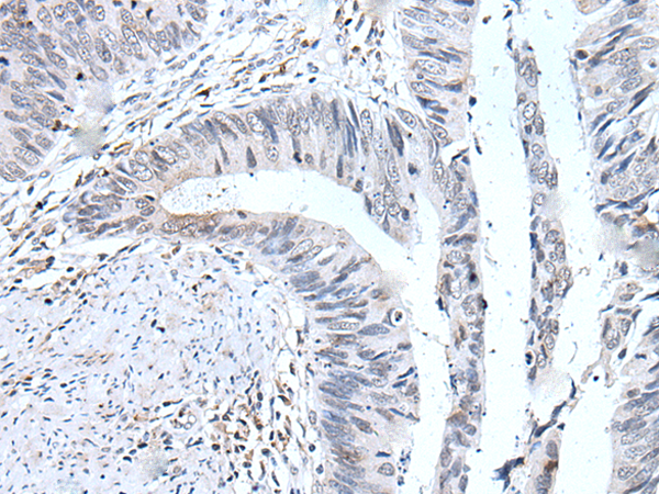 Rabbit Polyclonal Antibody to UBE2T