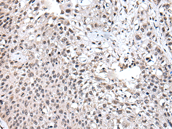 Rabbit Polyclonal Antibody to UBE2E3