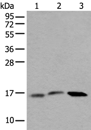 Rabbit Polyclonal Antibody to UBE2G2