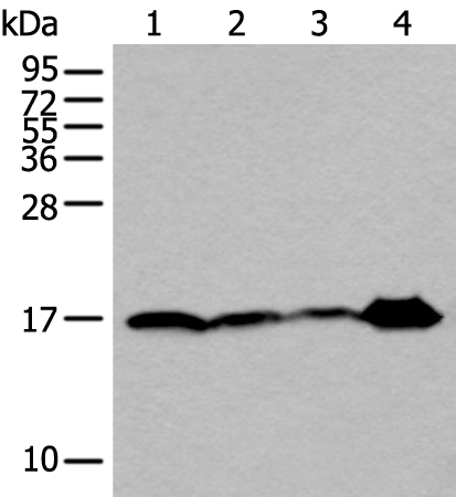 Rabbit Polyclonal Antibody to UBE2V2