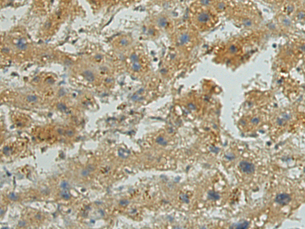 Rabbit Polyclonal Antibody to UBE2D1