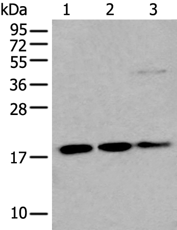 Rabbit Polyclonal Antibody to UBE2C