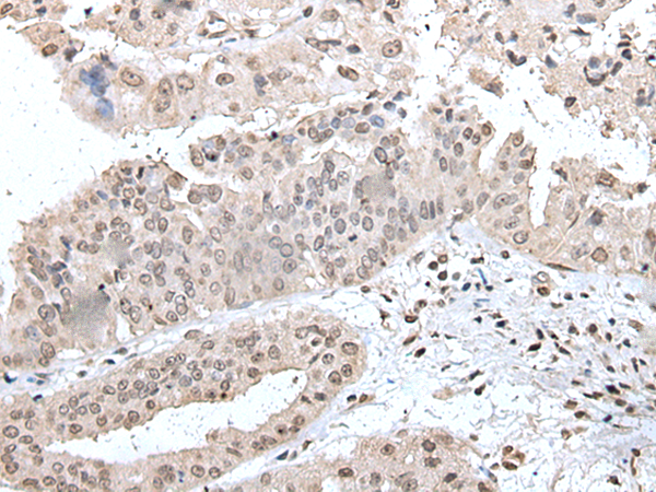 Rabbit Polyclonal Antibody to UBE2E2