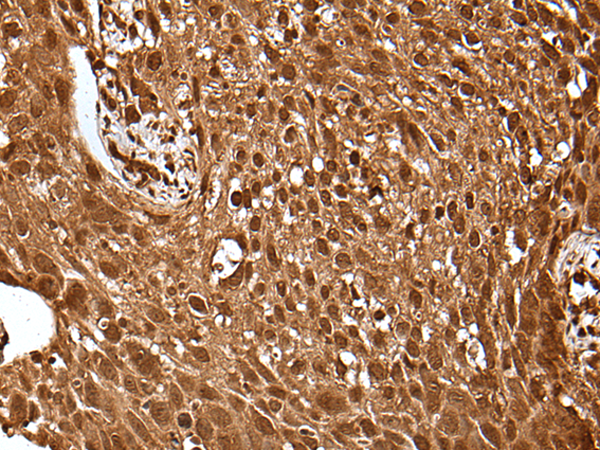 Rabbit Polyclonal Antibody to UBE4A