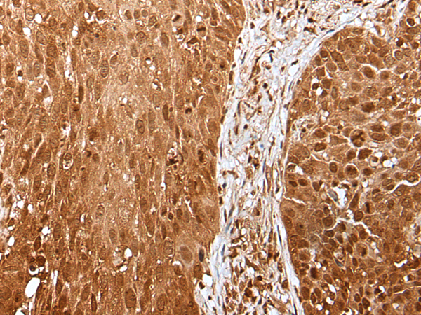 Rabbit Polyclonal Antibody to UBA7