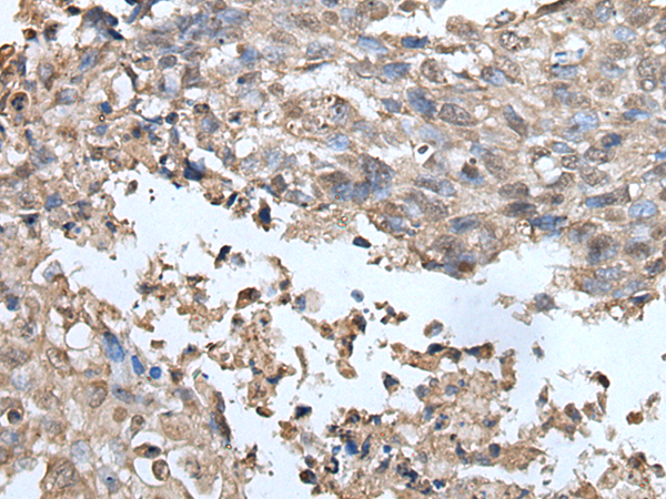 Rabbit Polyclonal Antibody to UBOX5