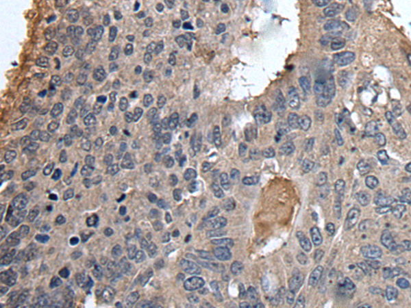 Rabbit Polyclonal Antibody to UBR2