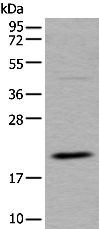 Rabbit Polyclonal Antibody to UFC1