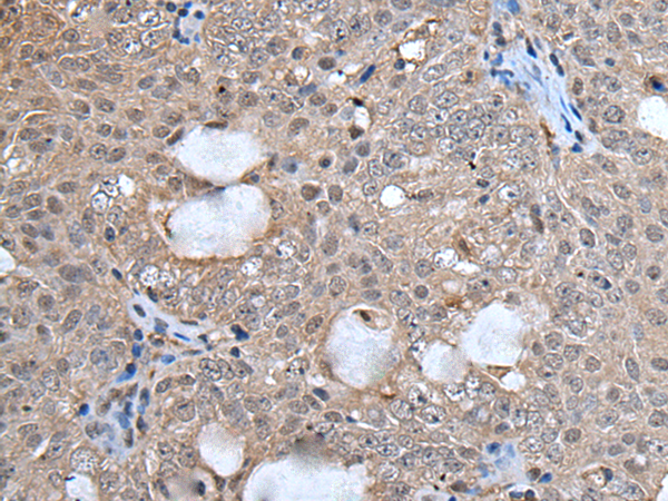 Rabbit Polyclonal Antibody to UFM1