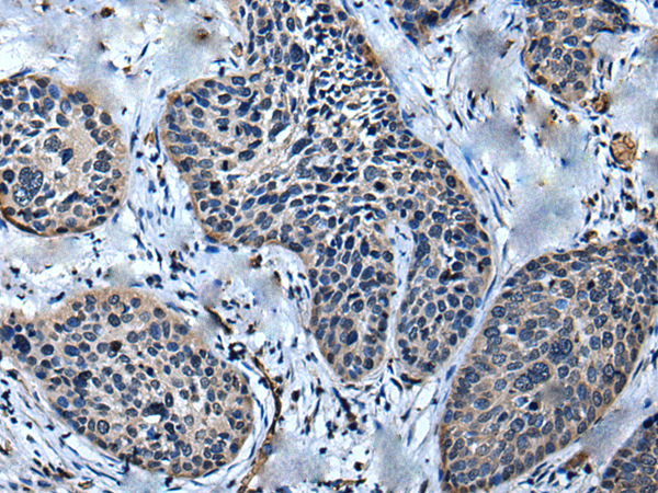 Rabbit Polyclonal Antibody to ULK4