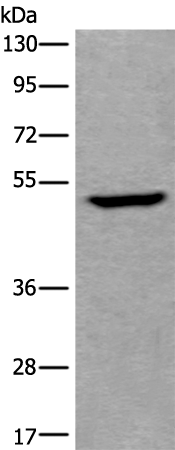 Rabbit Polyclonal Antibody to UMPS
