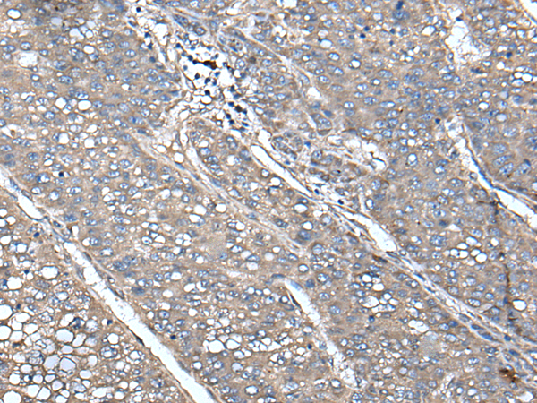 Rabbit Polyclonal Antibody to UNC13B