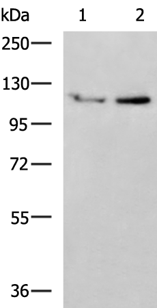 Rabbit Polyclonal Antibody to UNC5C