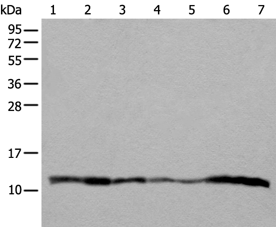 Rabbit Polyclonal Antibody to UQCRQ