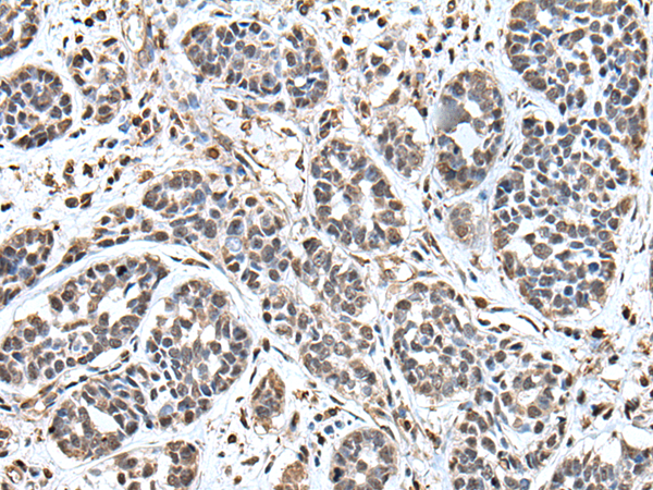 Rabbit Polyclonal Antibody to UPK3A