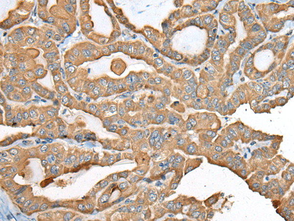 Rabbit Polyclonal Antibody to USP12