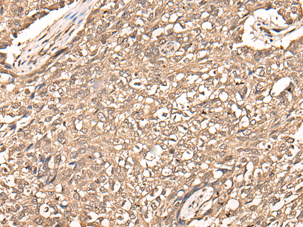 Rabbit Polyclonal Antibody to USP21