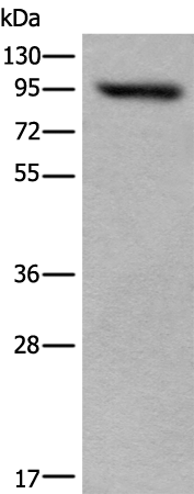 Rabbit Polyclonal Antibody to USP6NL