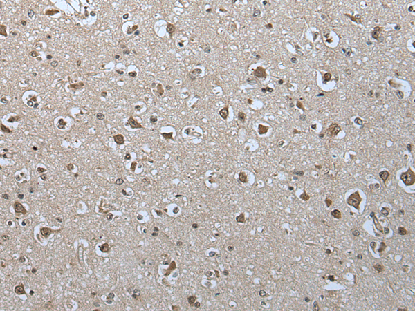 Rabbit Polyclonal Antibody to USP35