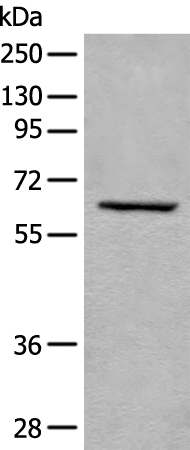 Rabbit Polyclonal Antibody to USP14