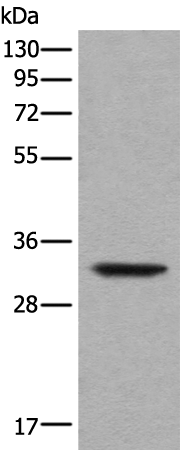 Rabbit Polyclonal Antibody to UTP11