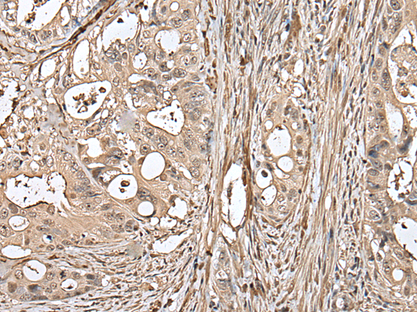 Rabbit Polyclonal Antibody to UTP3