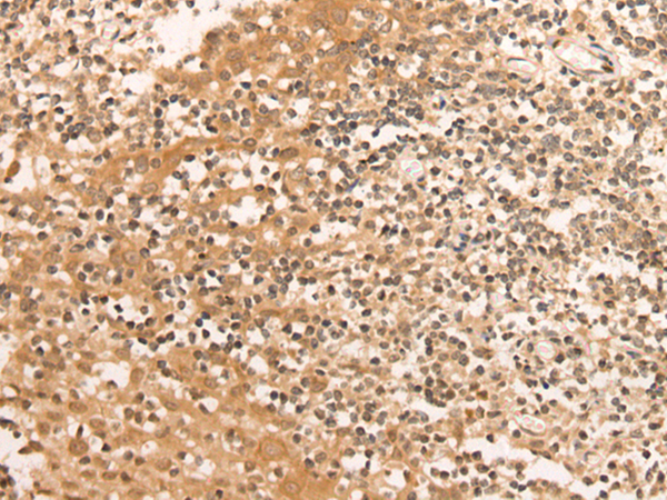 Rabbit Polyclonal Antibody to UTY