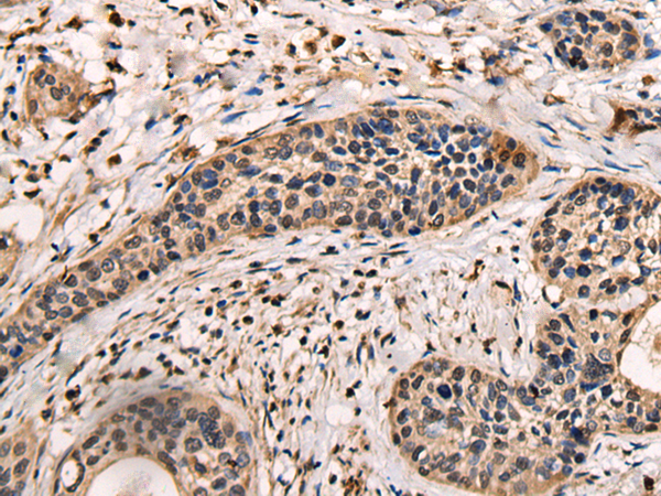 Rabbit Polyclonal Antibody to ASXL2