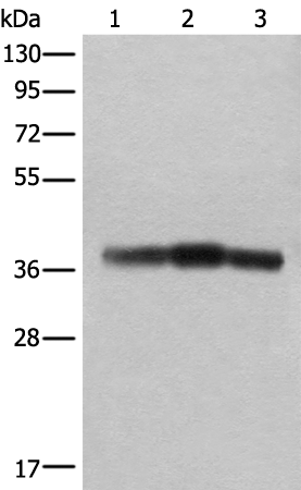 Rabbit Polyclonal Antibody to ATAD1