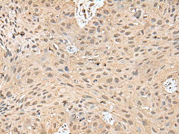 Rabbit Polyclonal Antibody to ATXN3
