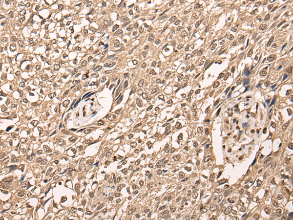 Rabbit Polyclonal Antibody to ATF7