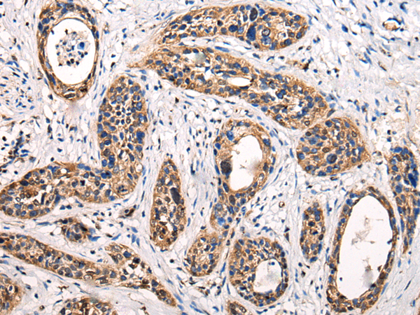 Rabbit Polyclonal Antibody to ATG9B