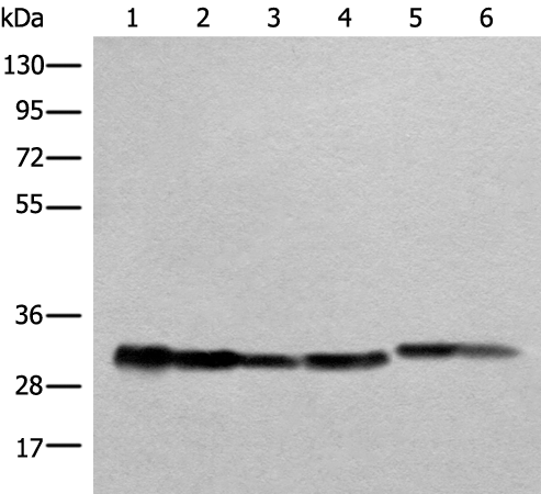 Rabbit Polyclonal Antibody to ATP5F1C